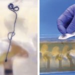 An illustration of a woman with chronic pain in her upper and lower back, wrists and feet